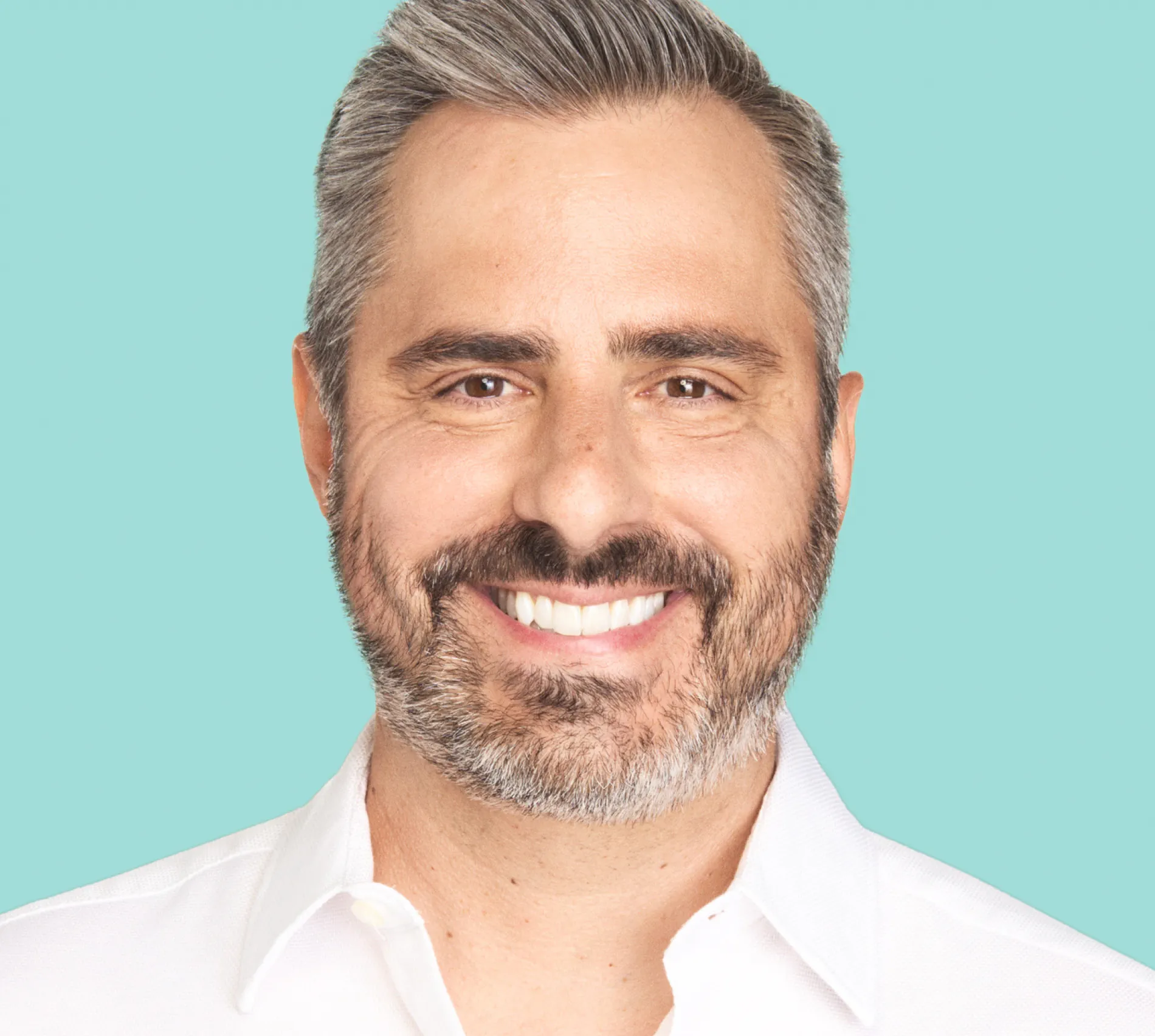 Darren before XEOMIN® treatment