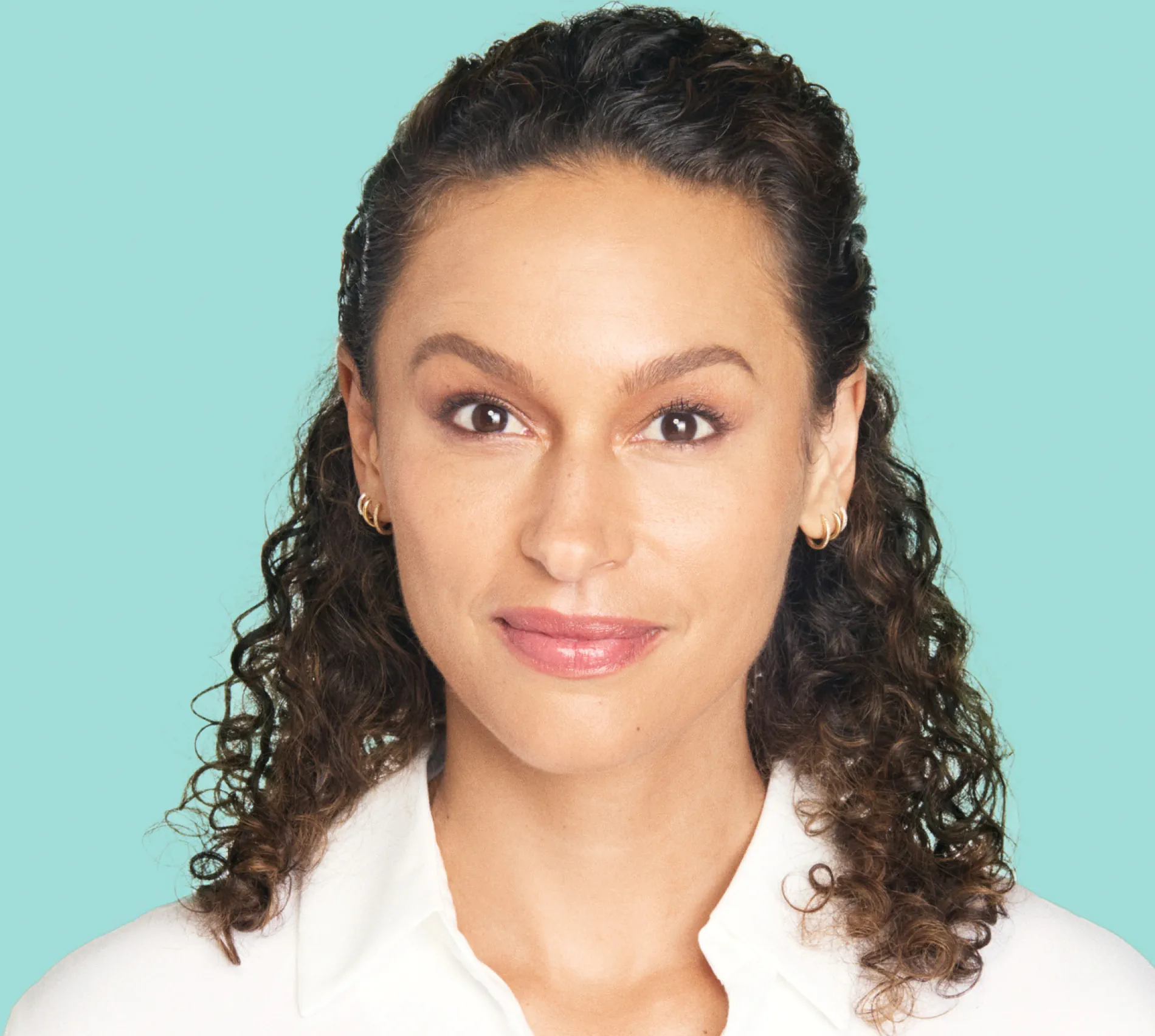 Erin before XEOMIN® treatment