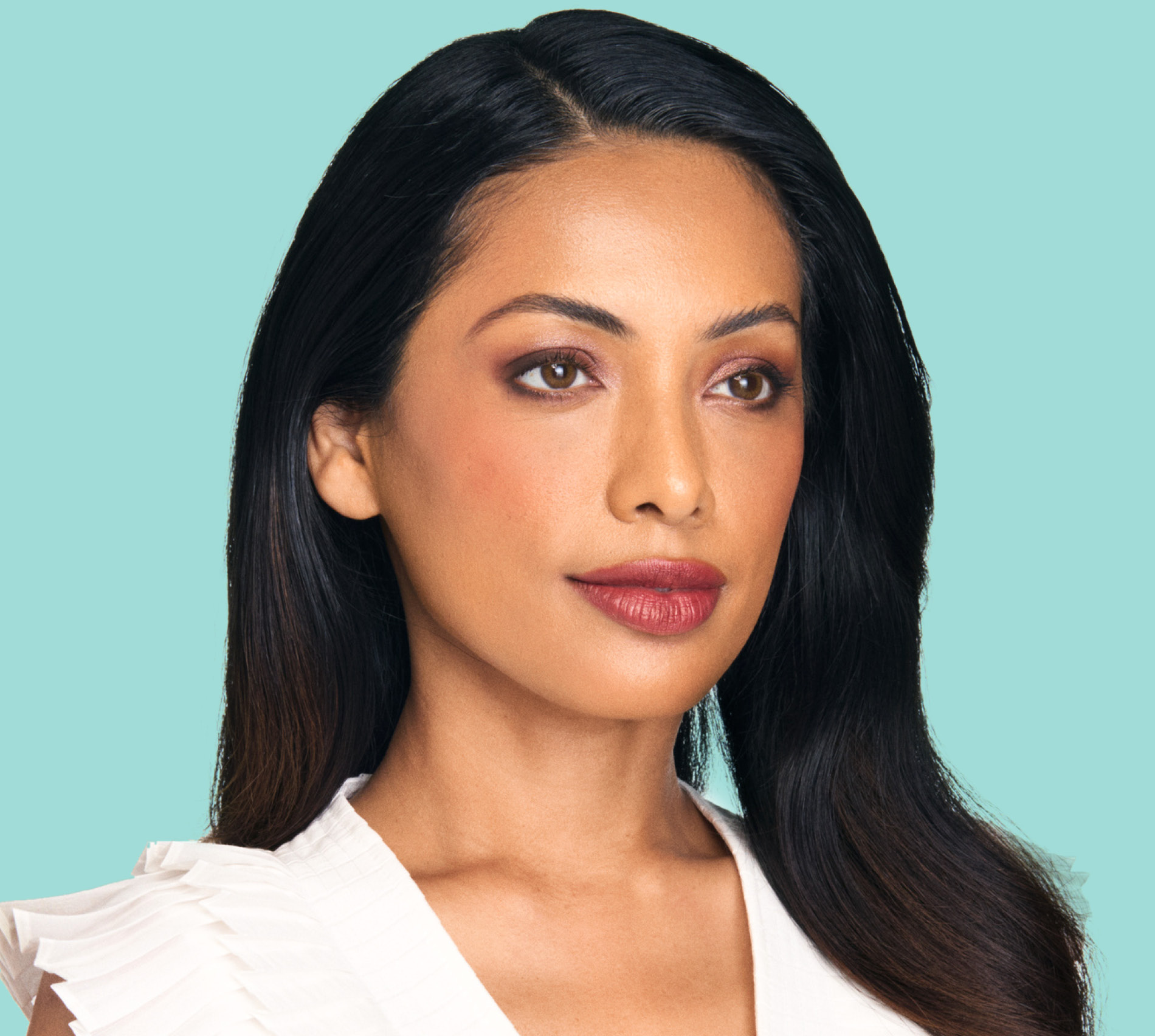 Riya before XEOMIN® treatment