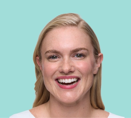 Before XEOMIN® treatment