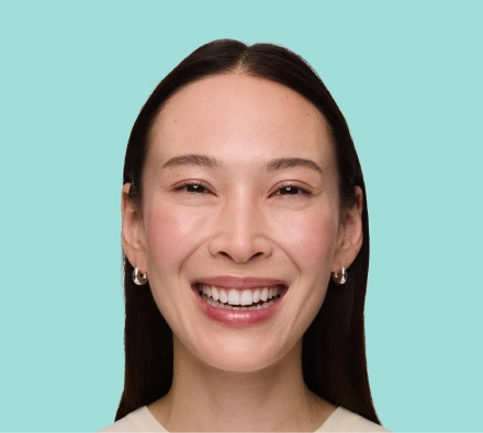 Before XEOMIN® treatment